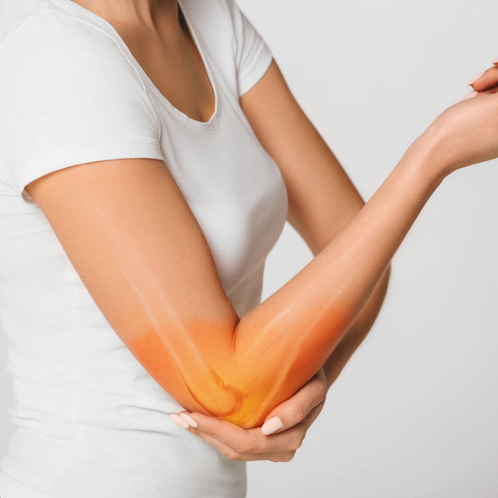 What is Tennis Elbow?
