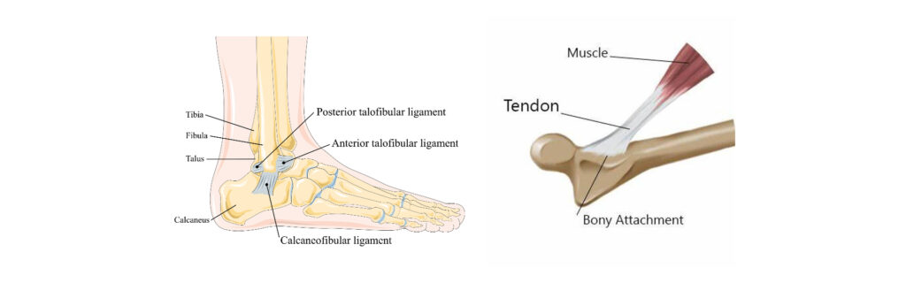 Sprain vs. Strain